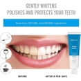 thumbnail image 4 of SDES-Niusmile Teeth Whitening Toothpaste | Activated Charcoal & Coconut Oil | SLS & Fluoride Free | Peppermint Taste, 4 of 4