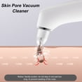 thumbnail image 3 of Kit Removedor de espinillas Abanopi Removedor de puntos negros Pore Vacuum 3 Potentes sondas de succión, 3 of 7