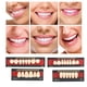 thumbnail image 5 of Material dental ANGGREK resina sintética dientes postizos Relleno, 5 of 8