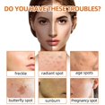 thumbnail image 2 of EIMELI 2Pcs Kojic Acid Soap  Lemon Turmeric Kojic Acid Soap  Turmeric Kojic Acid Soap for Dark Spots  Kojic Acid Soap Brightening Turmeric Kojic Soap  Orange Kojic Acid Soap  Dark Spots f, 2 of 7