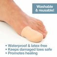 ZenToes Toe Caps Cushion Toes from Rubbing Shoes, Protect Missing and