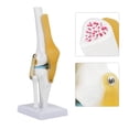 thumbnail image 1 of Knee Joint Model Anatomy Study, Mechanics Of The Knee Joint Knee Joint Model Vivid To Simulate The Bending  For Studio For Home For School For Work, 1 of 8