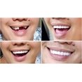 thumbnail image 4 of nipocaio Bright white fake dentures cosmetic teeth orthodontic teeth, 4 of 5