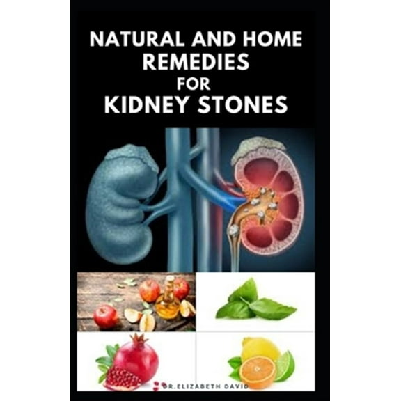Natural and Home Remedies for Kidney Stones, (Paperback), Dr Elizabeth David, English, 8.50" x 5.51" x 0.08"