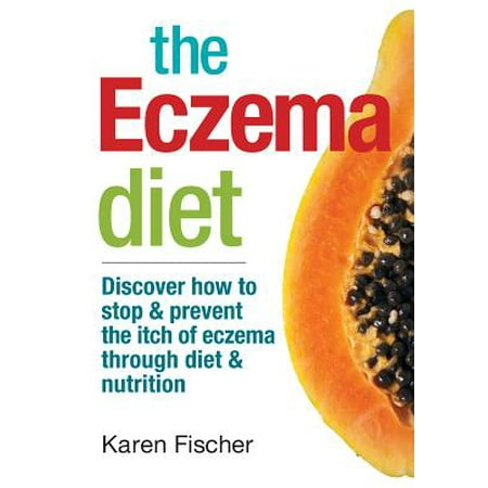 The Eczema Diet : Discover How to Stop and Prevent the Itch of Eczema Through Diet and (Best Diet For Eczema)
