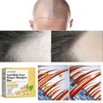thumbnail image 2 of Barra de champú de jengibre anticaída de JAYSUING, 1 unidad, aceite equilibrante que aumenta el volumen del cabello y nutre la raíz del cabello para el crecimiento del cabello, 2 of 5