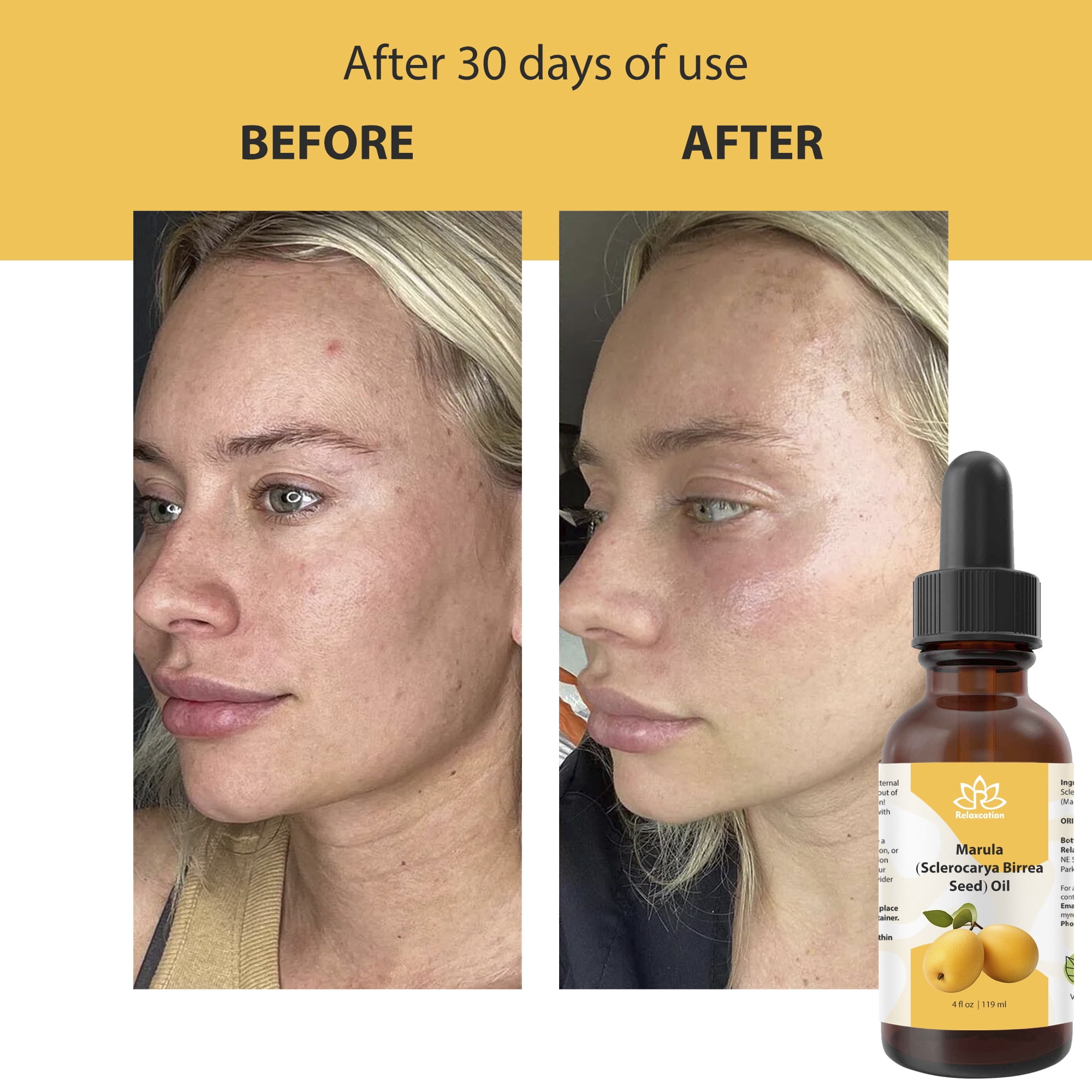 Pure Marula Organic Oil – 100% Cold-Pressed, Natural Face & Body Moisturizer 4 fl oz by Relaxcation