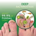OrientLeaf Nail Fungus Treatment, Toenail Fungus Treatment, Fungus Stop