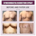 thumbnail image 5 of 2024 Spray Reductor de Ginecomastia Quemaduras y Reafirmante Elimina Tejido Mamario Ingredientes Naturales Anti Celulitis Elimina Edema, 5 of 5