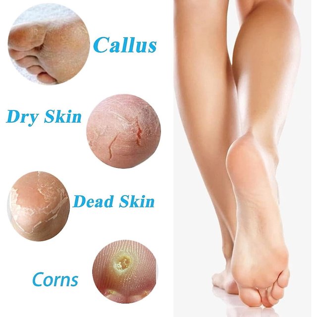 Limas para pies para piel dura, removedor de piel muerta dura, herramientas portátiles de pedicura de acero inoxidable LingWen 8390612360961