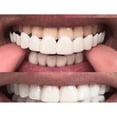 thumbnail image 3 of Simulación de sonrisa instantánea, aparatos dentales, blanqueamiento dental, pegatinas, sonrisa, dentadura postiza, aparatos dentales, 3 of 3