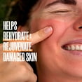 thumbnail image 2 of Zax's Original Camping Bundle (Bug Bite & Burn Creams), 2 of 6