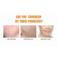 thumbnail image 3 of El sérum Peimei Vc Essence 30 ml reduce las líneas finas de melanina, 3 of 4