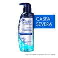 thumbnail image 1 of Shampoo Head & Shoulders Advanced limpieza radical menta y árbol de té 280 ml, 1 of 4