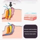 thumbnail image 4 of Tiras Para Dormir Para Niños, Telas No Tejidas Tipo O, Cinta Para La Boca Para Dormir Para Niños, Previene Los Ronquidos Para Uso En Viajes, 4 of 7