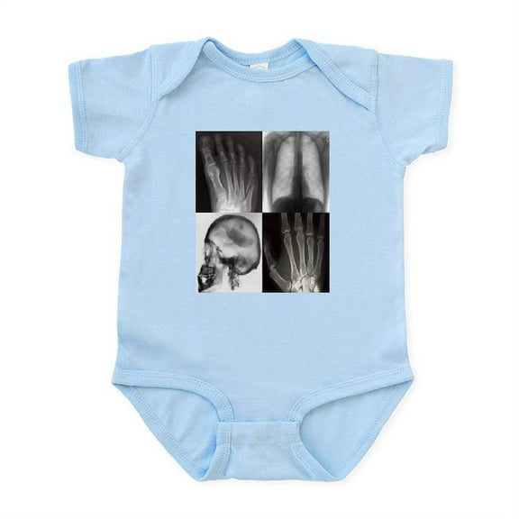 CafePress - 4Squarexray B Body Suit - Baby Light Bodysuit, Size Newborn - 24 Months