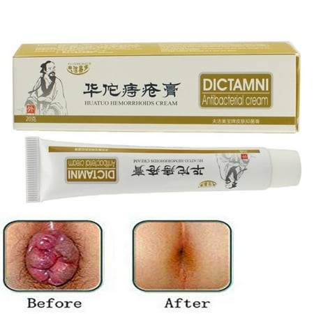 Fast Cure HuaTuo Hemorrhoids Cream Anus Pain Bleed Relief (Best Way To Cure Hemorrhoids)
