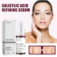 Density Of Salicylic Acid: A Comprehensive Guide - 7iczc4c