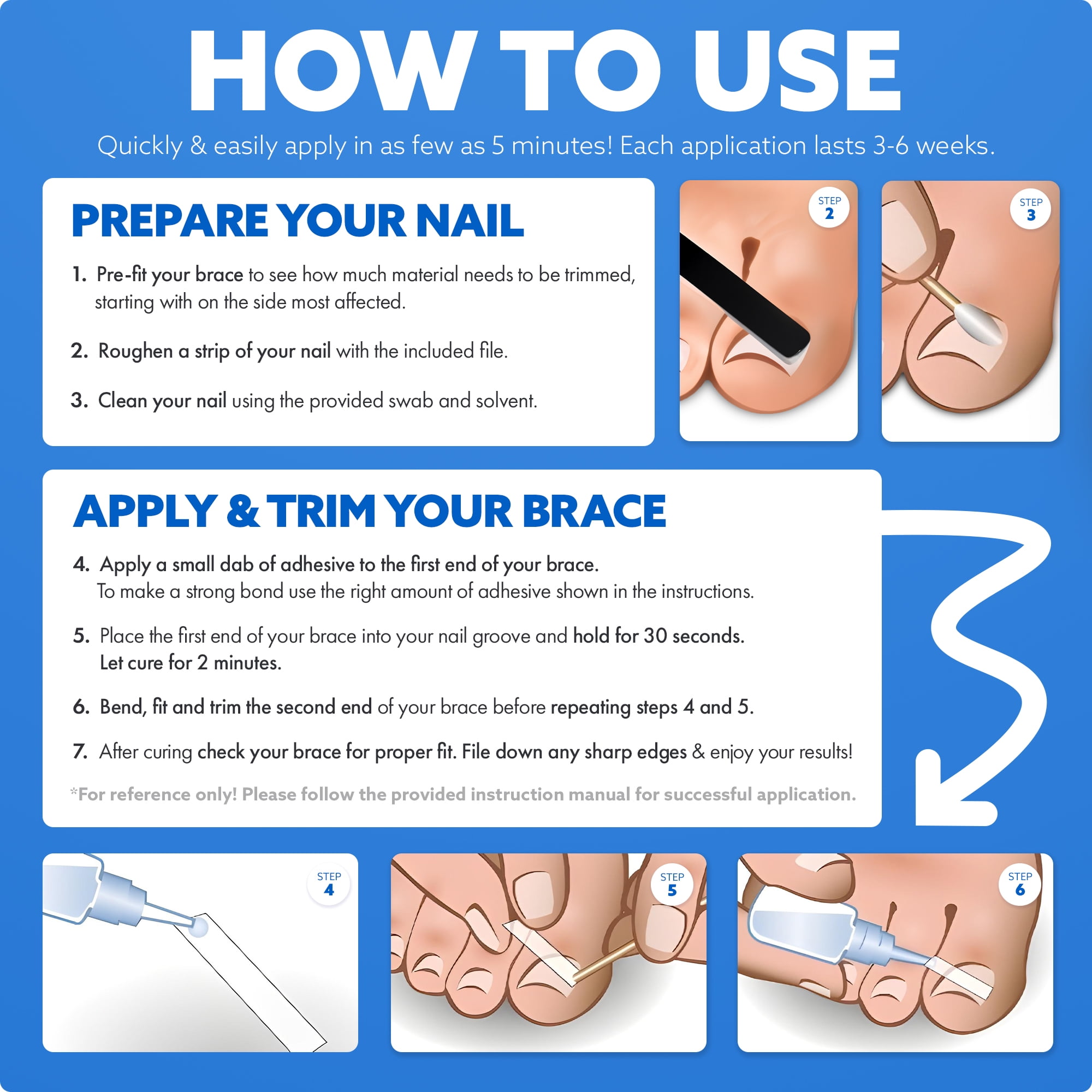 CurveCorrect® Ingrown Toenail Corrector Kit - 10 Braces for In Grown Toe Nail Treatment