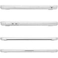 thumbnail image 5 of MOSISO Compatible with MacBook Pro 14 inch Case 2025-2021 M5 M4 M3 M2 M1 A3434 A3112 A3185 A3401 A2918 A2992 A2779 A2442, Heavy Duty Glitter Hard Shell with TPU Bumper&Keyboard Cover, 5 of 7