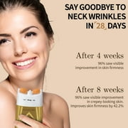 Ycz AH-8 Firming Neck Cream with Dual Roller Massager, Anti-Aging Moisturizer for Turkey Neck & Double Chin, V-Shape Lift & Tighten Formula, 4.23 fl.oz