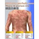 thumbnail image 2 of Pomada especial antibacteriana para psoriasis, tratamiento de musgo rebelde, psoriasis corporal y muslo, dermatosis, picazón, eczema, 2 of 5