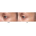 thumbnail image 4 of Suero Advanced Retinol Plus Ferulic Dr. Dennis Gross 0.5 oz, 4 of 8