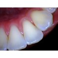 thumbnail image 2 of Intraoral Camera Dental, Works with Eaglesoft, Dexis, Apeteryx, Carestream, Tigerview, 2 of 6