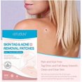thumbnail image 1 of 108 Uds removedor de marcas en la piel verrugas faciales verrugas de cuello plano ZefeiWu 8390614035614, 1 of 1