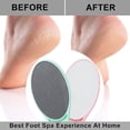 thumbnail image 5 of 2 Pack Nano Glass Foot File Callus Remover, Beomeen Hard and Dead Skin Remover for Feet, Double Sided Foot Scrubber Pedicure Tool, Hair Eraser for Softer & Smoother Feet, Random Black/White Glass, 5 of 10