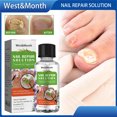 thumbnail image 1 of Reparación La Solución Uñas 30 Ml Eliminación Hongos Anti Infección Aceite Natural Onicomicosis Efectiva para El Cuidado Los Pies, 1 of 9