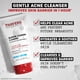 thumbnail image 3 of Limpiador facial THAYERS Blemish Clearing con 1,5% de ácido salicílico, 3 of 8