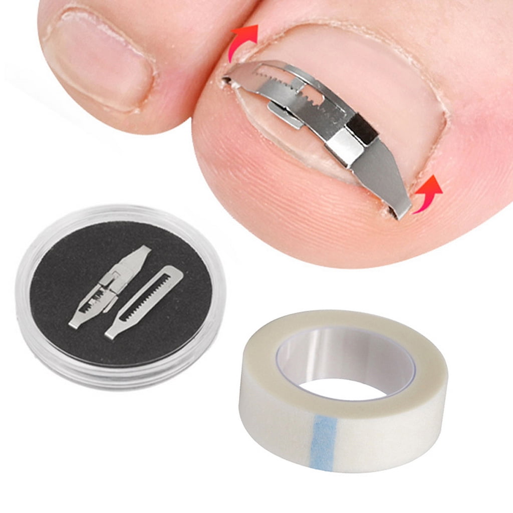 Carbon steel Ingrown Toenail Pedicure Tool Straightening Correction