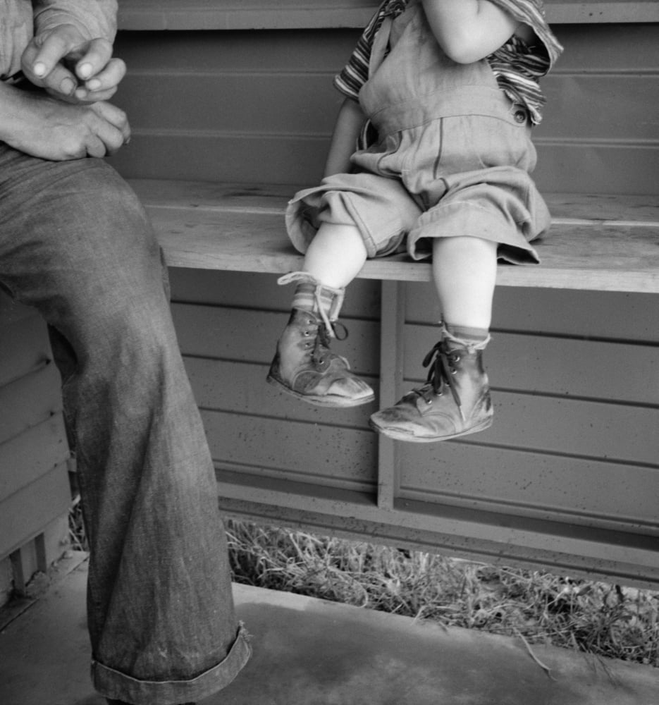 Club Foot, 1939. /Na Boy With Club Feet Wearing Homemade Splints At A