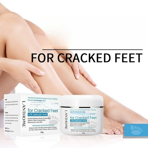 Urea Cream For Cracked Feet