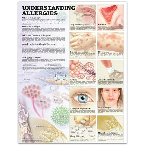 Understanding Allergies Anatomical Chart