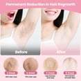 thumbnail image 3 of Portable Hair Removal for Women Painless Hair Removal for Home Use Portable Hair Removal Device for Home Use US Plug, 3 of 5