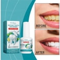 thumbnail image 4 of Pintura dental, pulidor de dientes, pintura instantánea para dientes, sérum limpiador dental para pulir y eliminar manchas, 15 ml. Cuidado dental., 4 of 9
