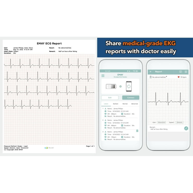 EMAY Bluetooth EKG Machine Portable ECG Monitor for iPhone Android Mac Windows Walmart