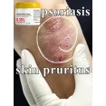 thumbnail image 2 of Crema antihongos para Psoriasis, tratamiento de infección por hongos para la piel, crema médica para Psoriasis, pomada para el tratamiento de picazón de la piel, 2 of 5