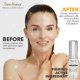 thumbnail image 4 of Loción Tret-A Retinaldehído 0.15% Tratamiento Facial Avanzado Anti-Aging y Aclarante 15ml, 4 of 7