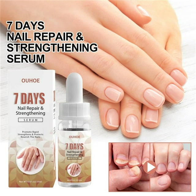 Sérum fortalecedor y para el crecimiento de uñas durante 7 días, reparador de uñas, para uñas de los pies, para reparar uñas dañadas y descoloridas, solución reparadora de uñas de 20 ml