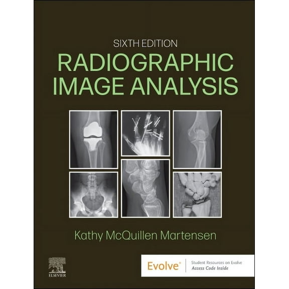 Radiographic Image Analysis, (Hardcover)