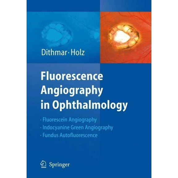 Fluorescence Angiography in Ophthalmology, (Hardcover)