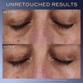 thumbnail image 3 of Crema de ojos Lancôme Génifique para ojeras 20 ml, 3 of 5