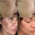 thumbnail image 4 of Crema blanqueadora de pecas, puntos negros, melasma, antimanchas, aclara la pigmentación, hidratante, productos coreanos para el cuidado de la piel, 4 of 6