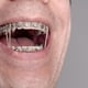 thumbnail image 5 of 100 unidades de gomas elásticas de 3,5 oz de caucho natural para uso ortodóntico y dental, trenzas de pelo, crin de caballo, maquetas de aviones, estuche de plástico multiusos, 5 of 7