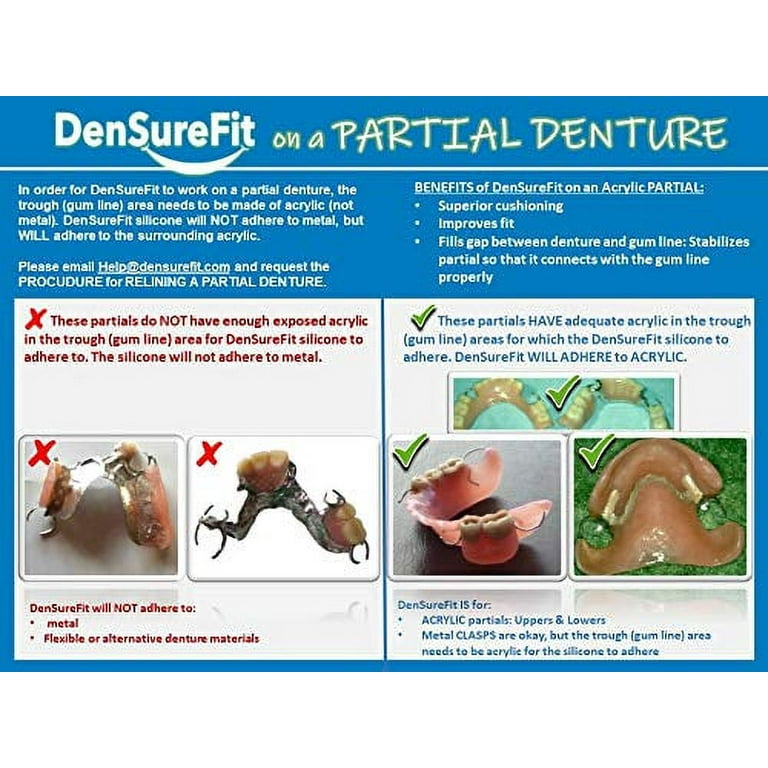 DenSureFit OVERVIEW - Soft Supple Silicone Denture Reliner 