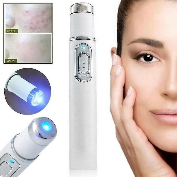 Spider Vein Eraser Eliminación de luz azul Borrador Terapia Arrugas Acné Lápiz láser Cicatriz