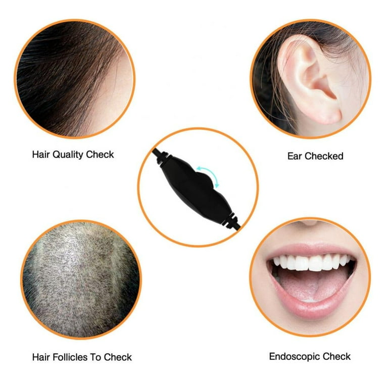 endoscope ear wax